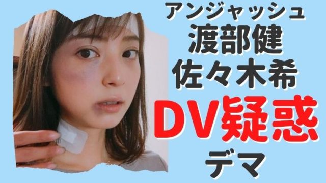 渡部健の佐々木希へのdv疑惑はデマ 痛々しい写真は特殊メイク 思い立ったが吉日